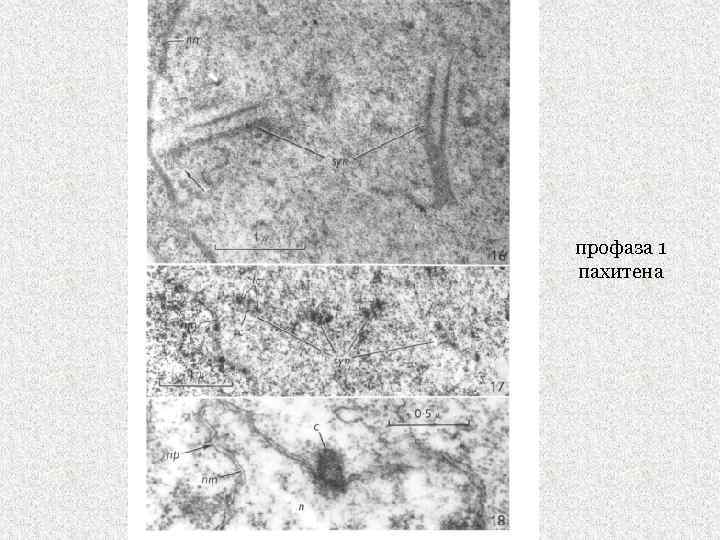 профаза 1 пахитена 