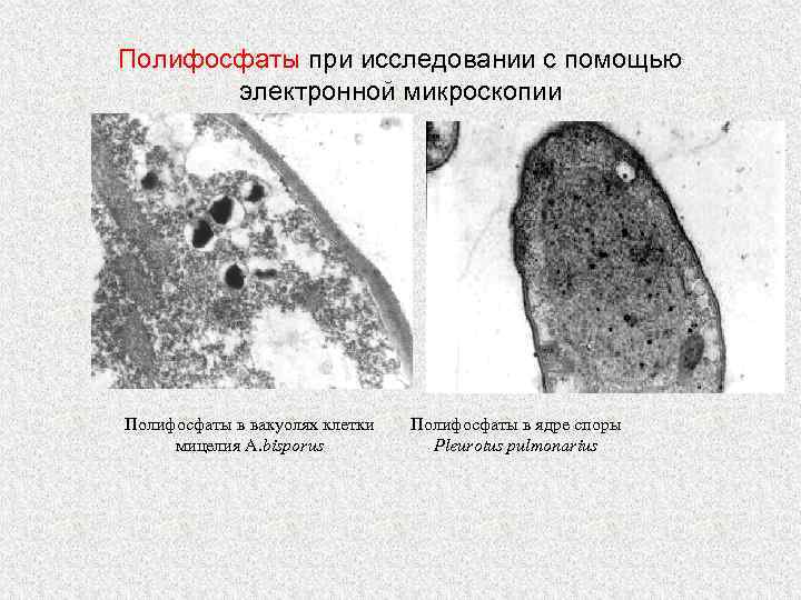 Полифосфаты при исследовании с помощью электронной микроскопии Полифосфаты в вакуолях клетки мицелия A. bisporus