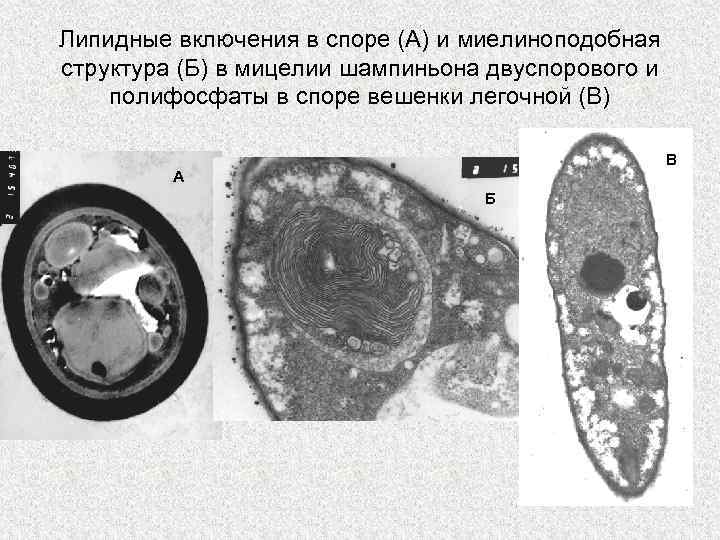 Липидные включения в споре (А) и миелиноподобная структура (Б) в мицелии шампиньона двуспорового и