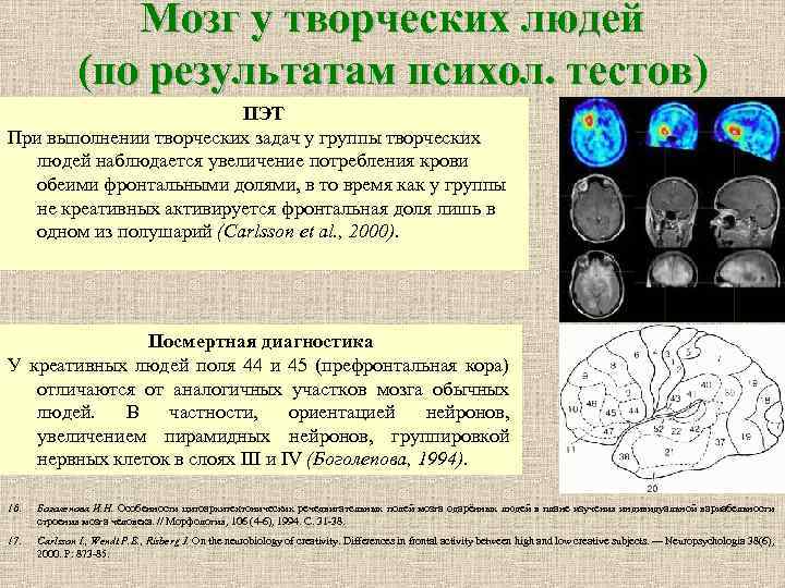 Мозг у творческих людей (по результатам психол. тестов) ПЭТ При выполнении творческих задач у