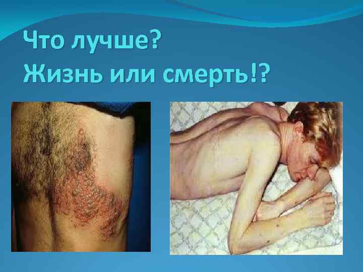 Что лучше? Жизнь или смерть!? 