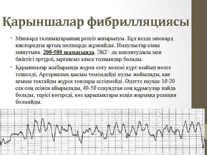 Қарыншалар фибрилляциясы • Миокард талшықтарының ретсіз жиырылуы. Бұл кезде миокард кислородты артық мөлшерде жұмсайды.