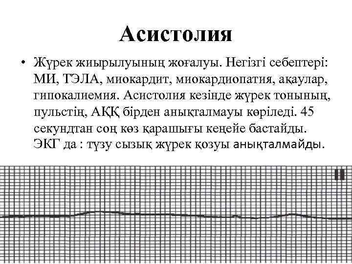 Асистолия • Жүрек жиырылуының жоғалуы. Негізгі себептері: МИ, ТЭЛА, миокардит, миокардиопатия, ақаулар, гипокалиемия. Асистолия