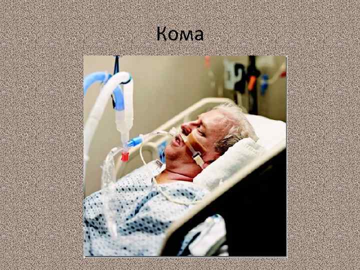 Кома 