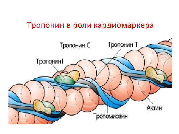  Тропонин в роли кардиомаркера 