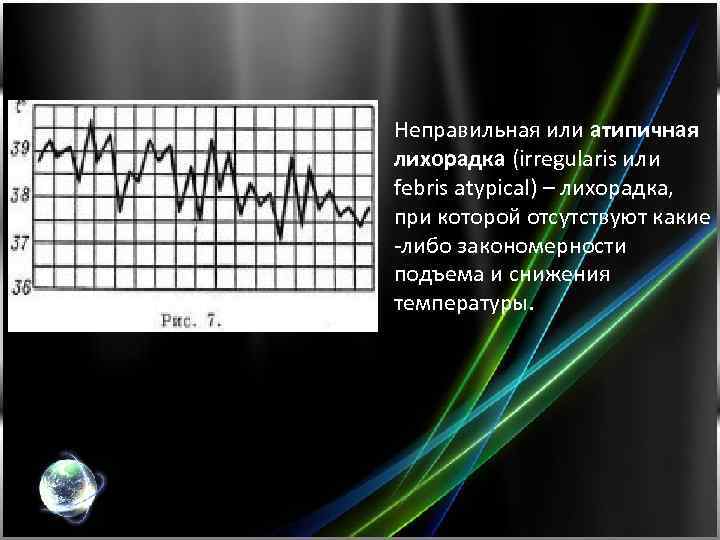 Неправильная или атипичная лихорадка (irregularis или febris atypical) – лихорадка, при которой отсутствуют какие