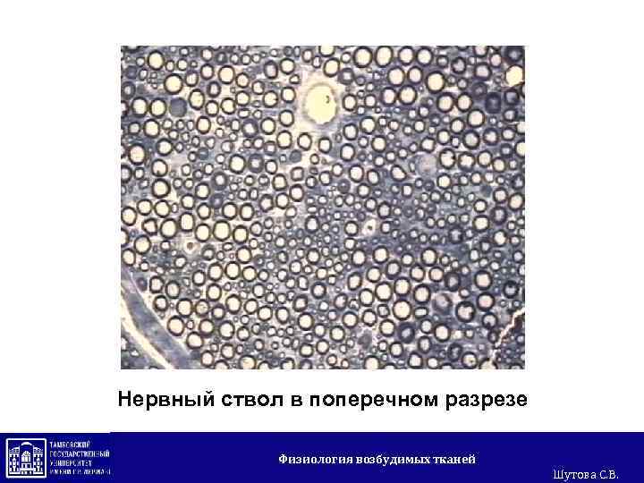Нервный ствол в поперечном разрезе Физиология возбудимых тканей Шутова С. В. 
