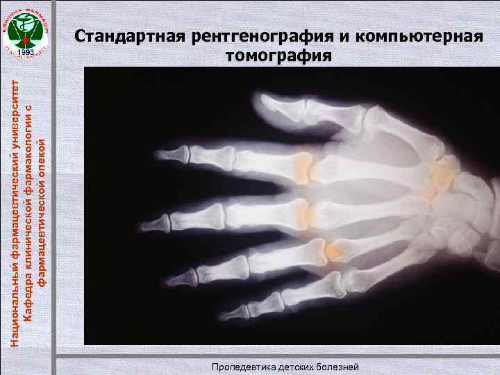 Национальный фармацевтический университет Кафедра клинической фармакологии с фармацевтической опекой Стандартная рентгенография и компьютерная томография