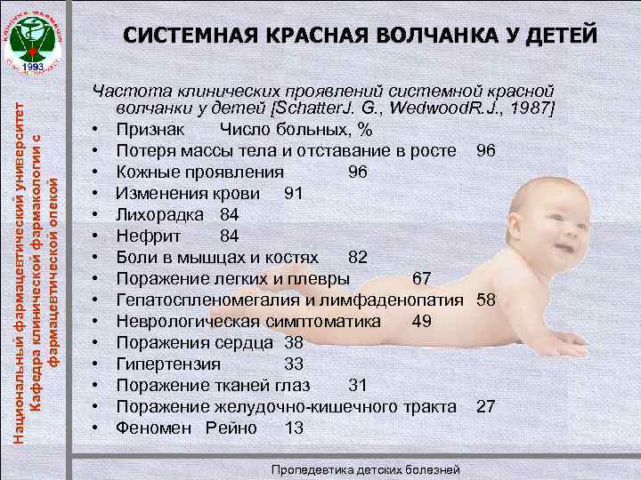 Национальный фармацевтический университет Кафедра клинической фармакологии с фармацевтической опекой СИСТЕМНАЯ КРАСНАЯ ВОЛЧАНКА У ДЕТЕЙ