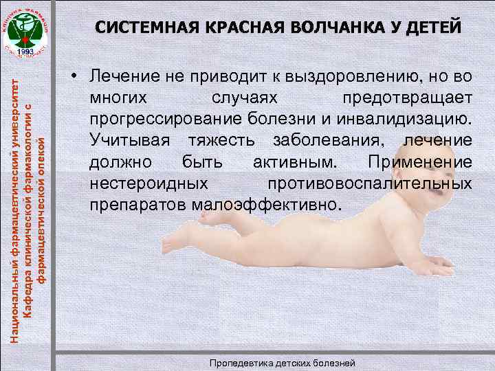 Национальный фармацевтический университет Кафедра клинической фармакологии с фармацевтической опекой СИСТЕМНАЯ КРАСНАЯ ВОЛЧАНКА У ДЕТЕЙ