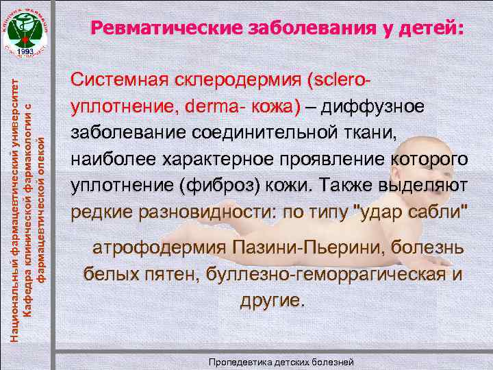 Национальный фармацевтический университет Кафедра клинической фармакологии с фармацевтической опекой Ревматические заболевания у детей: Системная
