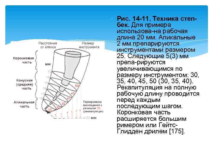  Рис. 14 -11. Техника степбек. Для примера использова на рабочая длина 20 мм.