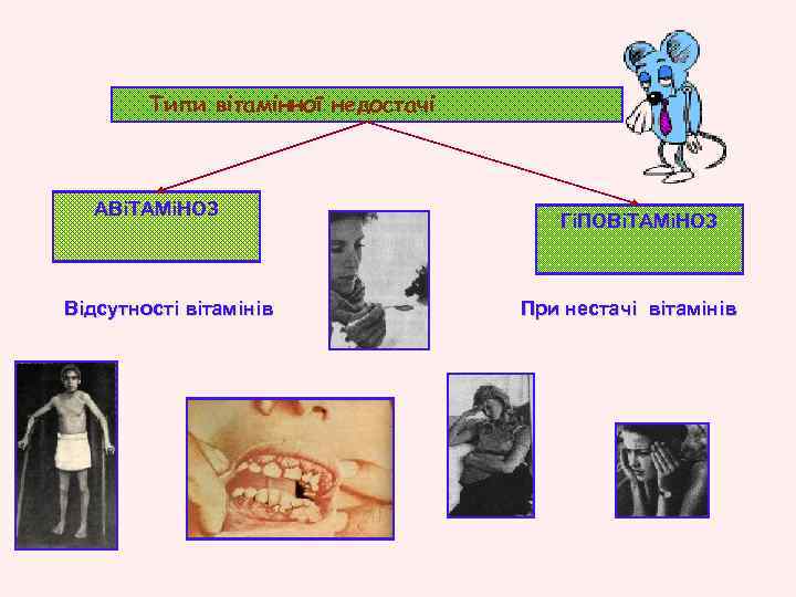 Типи вітамінної недостачі АВіТАМіНОЗ Відсутності вітамінів ГіПОВіТАМіНОЗ При нестачі вітамінів 