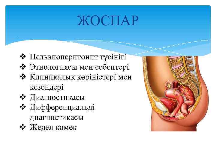 ЖОСПАР v v Пельвиоперитонит түсінігі v Этиологиясы мен себептері v Клиникалық көріністері мен кезеңдері