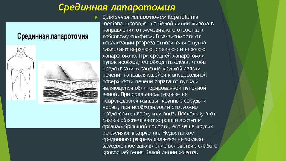 Срединная лапаротомия (laparotomia mediana) проводят по белой линии живота в направлении от мечевидного отростка