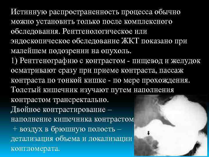 Истинную распространенность процесса обычно можно установить только после комплексного обследования. Рентгенологическое или эндоскопическое обследование