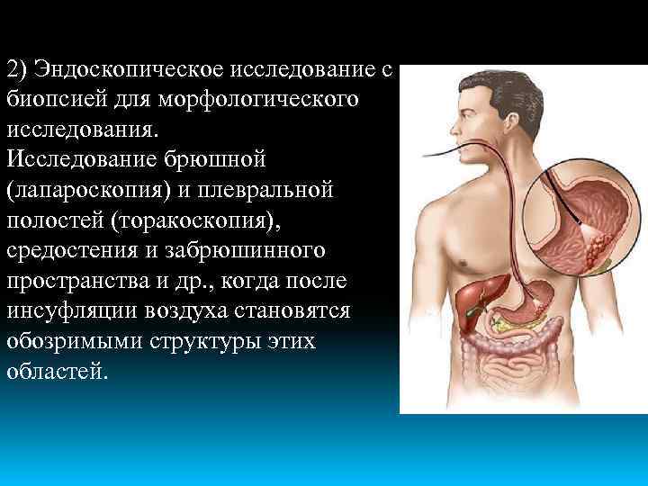 2) Эндоскопическое исследование с биопсией для морфологического исследования. Исследование брюшной (лапароскопия) и плевральной полостей