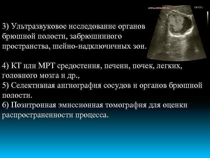 3) Ультразвуковое исследование органов брюшной полости, забрюшинного пространства, шейно-надключичных зон. 4) КТ или МРТ