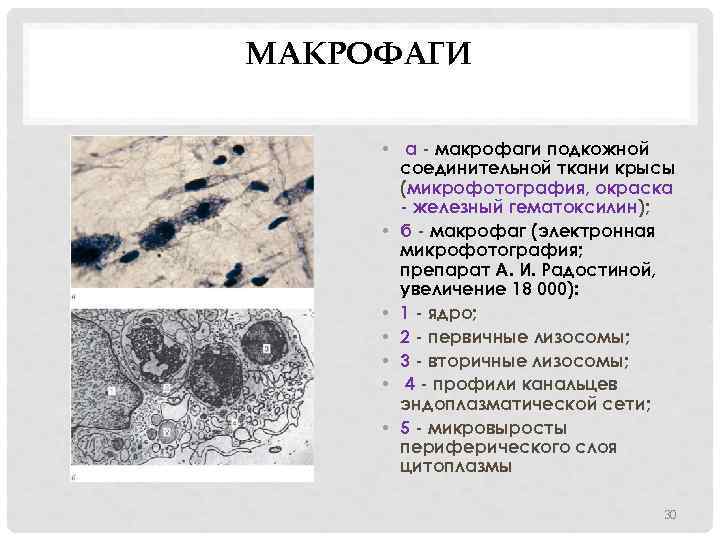 МАКРОФАГИ • а - макрофаги подкожной соединительной ткани крысы (микрофотография, окраска - железный гематоксилин);