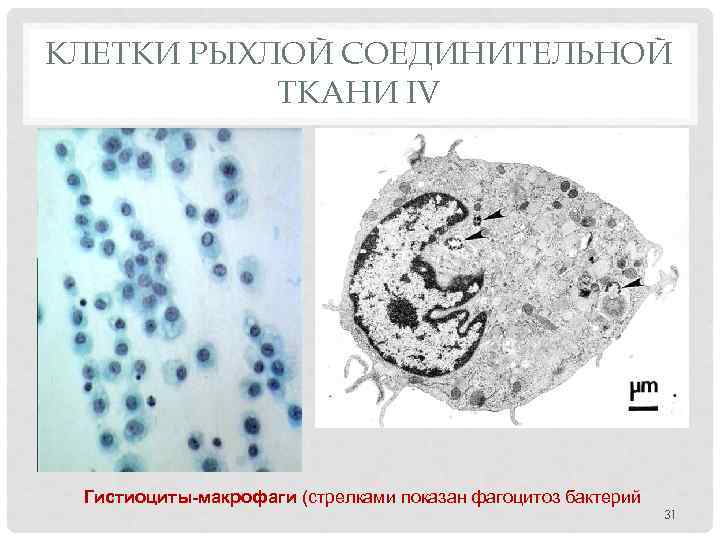 КЛЕТКИ РЫХЛОЙ СОЕДИНИТЕЛЬНОЙ ТКАНИ IV Гистиоциты-макрофаги (стрелками показан фагоцитоз бактерий 31 