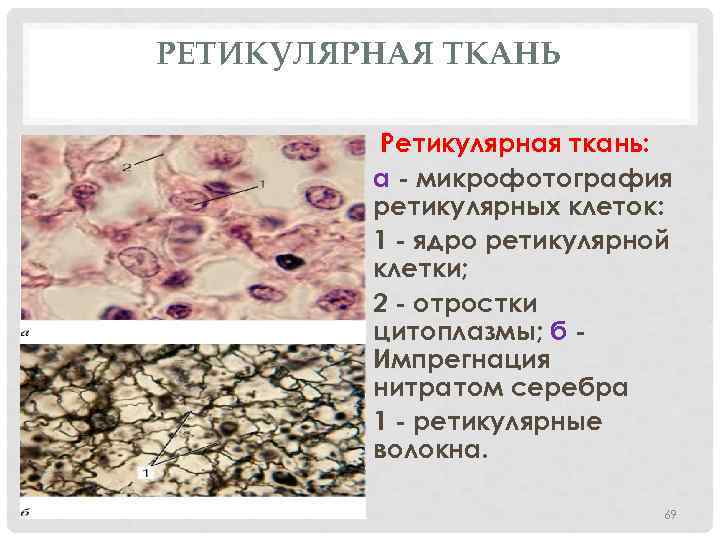 РЕТИКУЛЯРНАЯ ТКАНЬ Ретикулярная ткань: а - микрофотография ретикулярных клеток: 1 - ядро ретикулярной клетки;