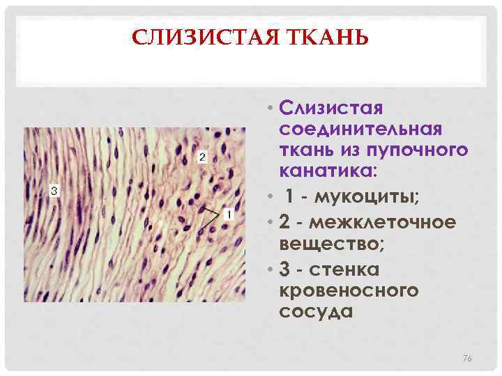 СЛИЗИСТАЯ ТКАНЬ • Слизистая соединительная ткань из пупочного канатика: • 1 - мукоциты; •