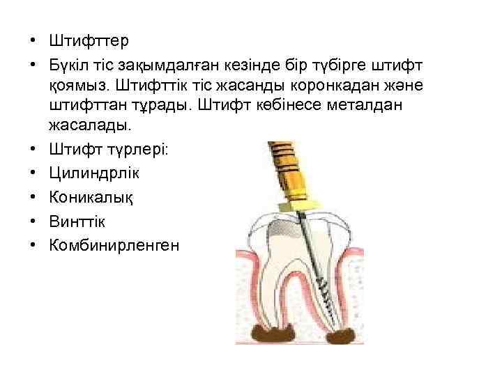  • Штифттер • Бүкіл тіс зақымдалған кезінде бір түбірге штифт қоямыз. Штифттік тіс