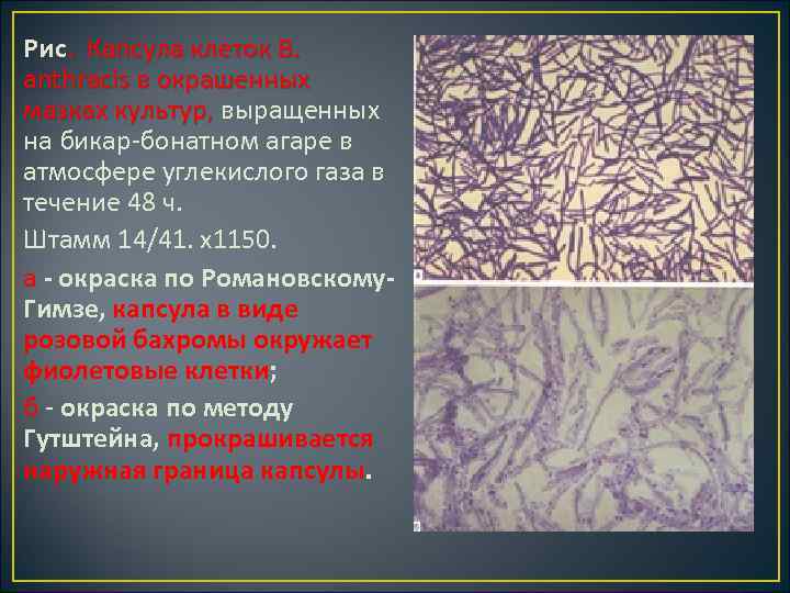 Рис. Капсула клеток В. anthracis в окрашенных мазках культур, выращенных мазках культур, на бикар