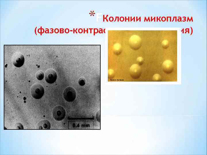 *FКолонии микоплазм (фазово-контрастная микроскопия) 
