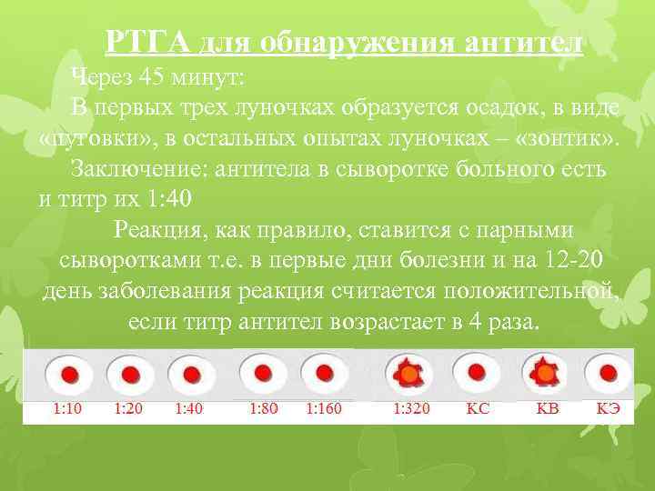 РТГА для обнаружения антител Через 45 минут: В первых трех луночках образуется осадок, в