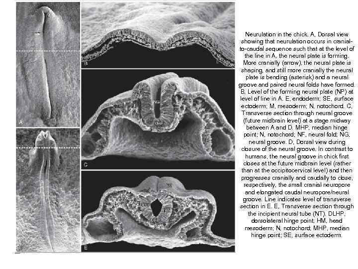 Neurulation in the chick. A, Dorsal view showing that neurulation occurs in cranialto-caudal sequence