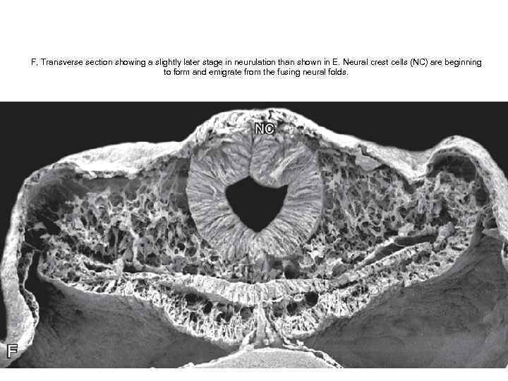 F, Transverse section showing a slightly later stage in neurulation than shown in E.