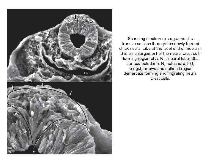 Scanning electron micrographs of a transverse slice through the newly formed chick neural tube