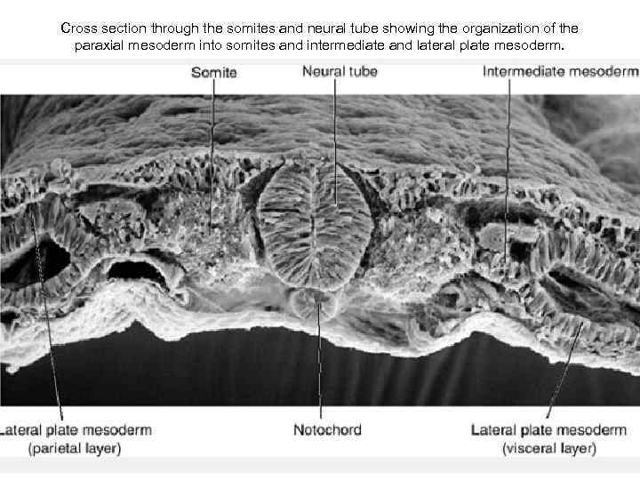 Cross section through the somites and neural tube showing the organization of the paraxial