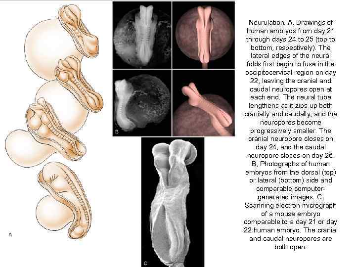 Neurulation. A, Drawings of human embryos from day 21 through days 24 to 25