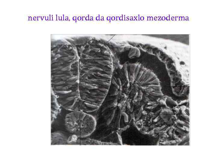 nervuli lula, qorda da qordisaxlo mezoderma 