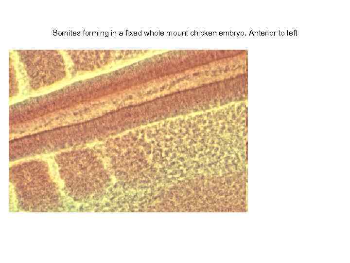 Somites forming in a fixed whole mount chicken embryo. Anterior to left 