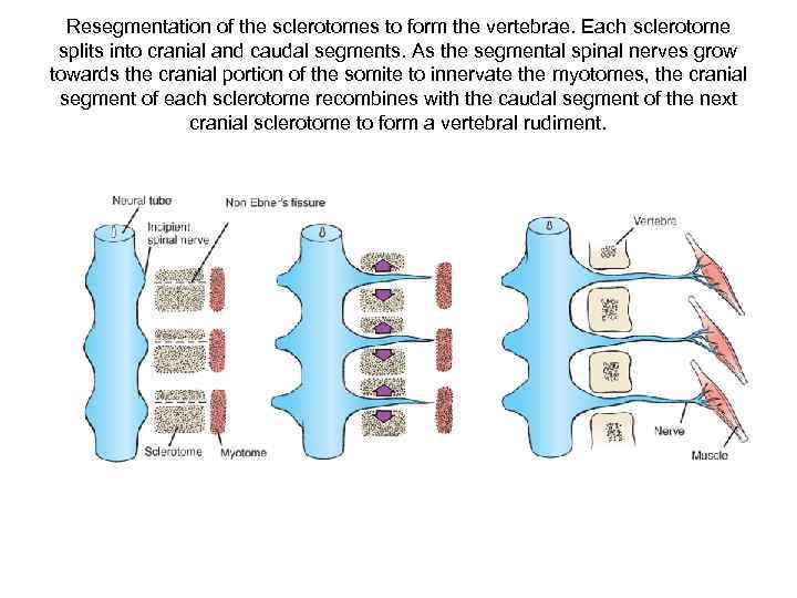 Resegmentation of the sclerotomes to form the vertebrae. Each sclerotome splits into cranial and