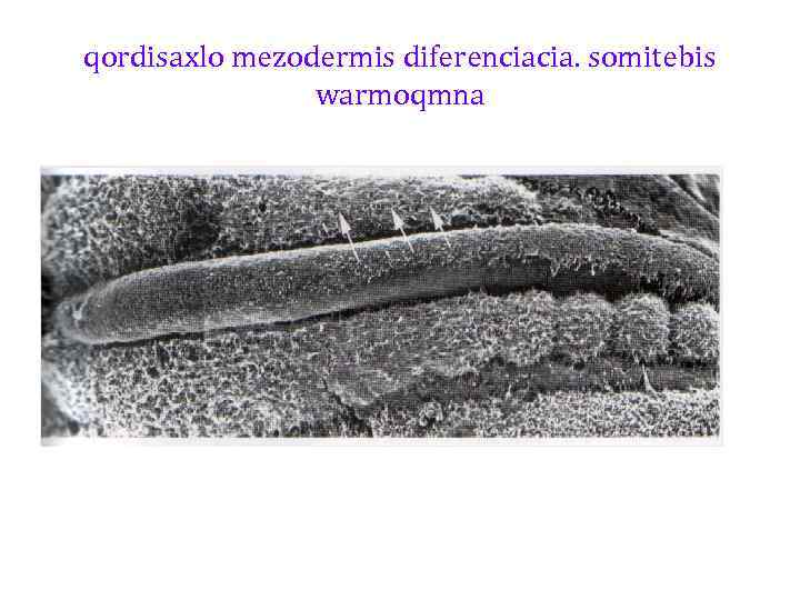 qordisaxlo mezodermis diferenciacia. somitebis warmoqmna 