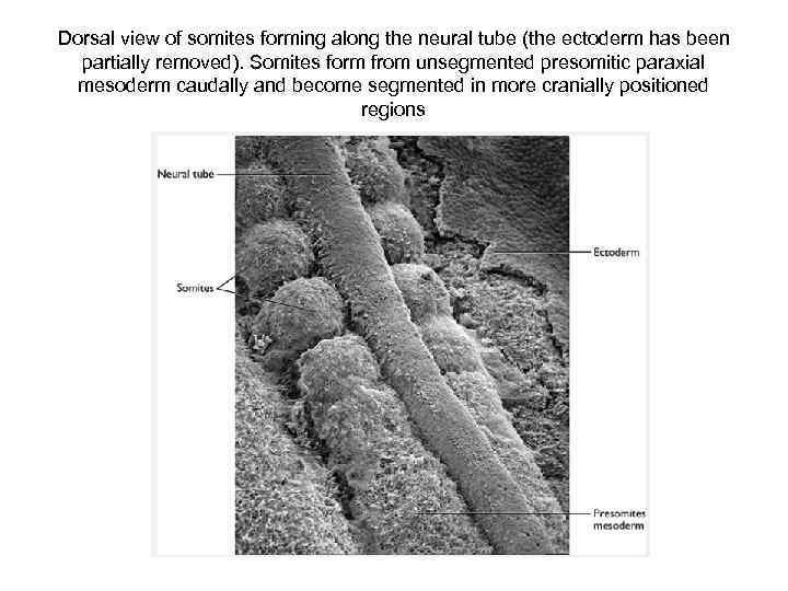 Dorsal view of somites forming along the neural tube (the ectoderm has been partially