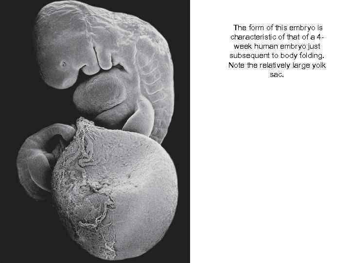 The form of this embryo is characteristic of that of a 4 week human