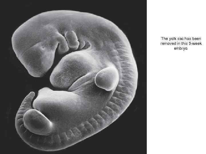 The yolk sac has been removed in this 5 -week embryo. 