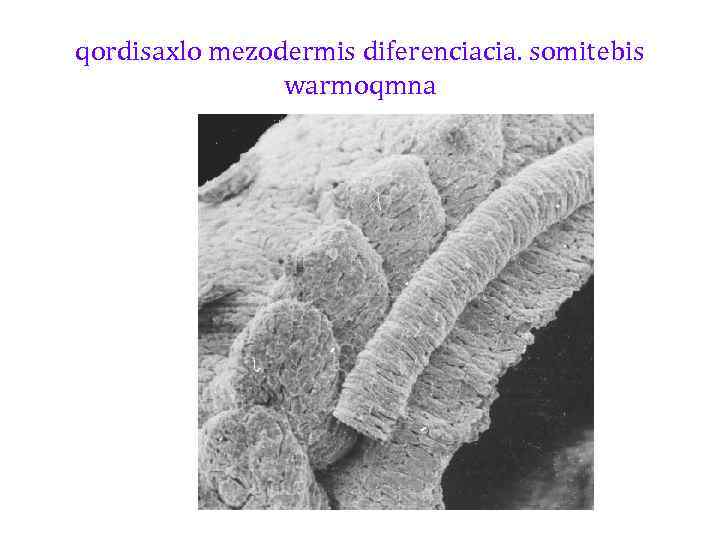 qordisaxlo mezodermis diferenciacia. somitebis warmoqmna 