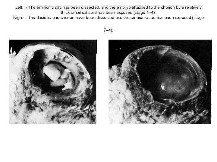 Left - The amnionic sac has been dissected, and the embryo attached to the