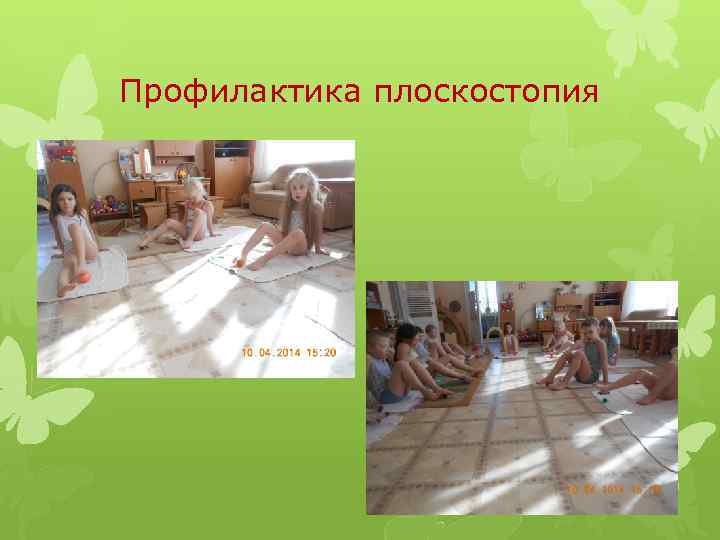 Профилактика плоскостопия 