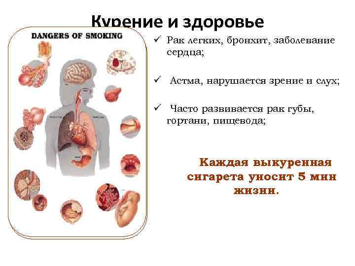 Курение и здоровье ü Рак легких, бронхит, заболевание сердца; ü Астма, нарушается зрение и