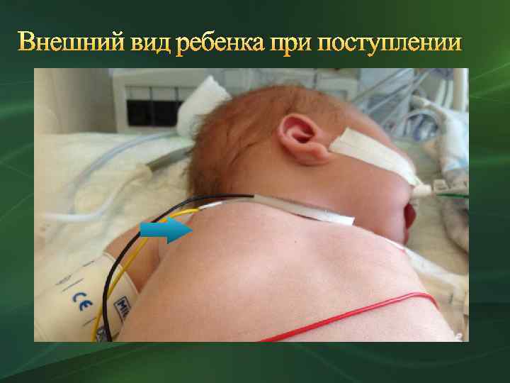 Внешний вид ребенка при поступлении 