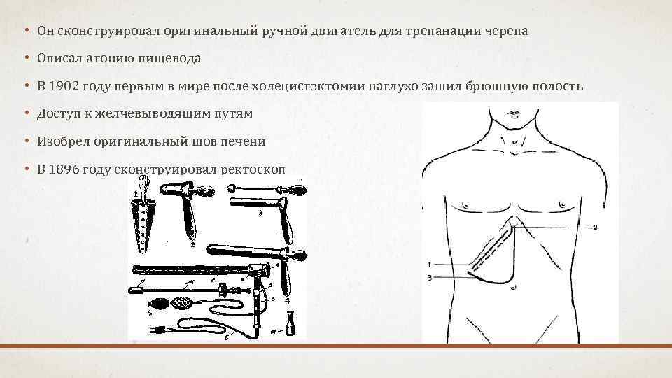  • Он сконструировал оригинальный ручной двигатель для трепанации черепа • Описал атонию пищевода