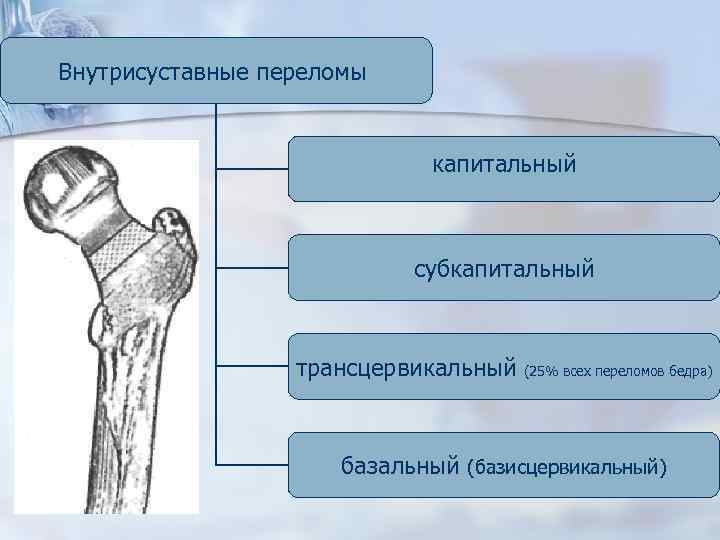 Внутрисуставные переломы капитальный субкапитальный трансцервикальный (25% всех переломов бедра) базальный (базисцервикальный) 