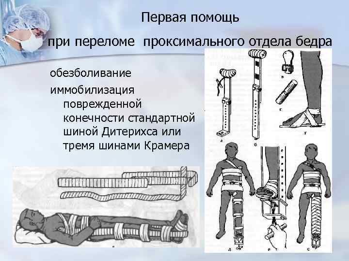 Какой должна быть транспортная шина